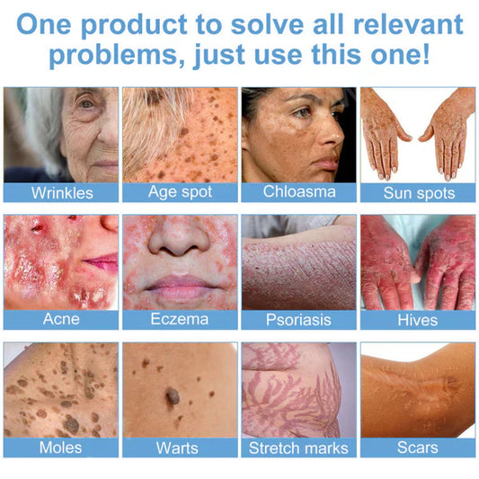 𝗝𝗼𝗿𝗼𝗻𝗱𝘆® Bee Bright Multi-Symptom Skin Treatment Cream