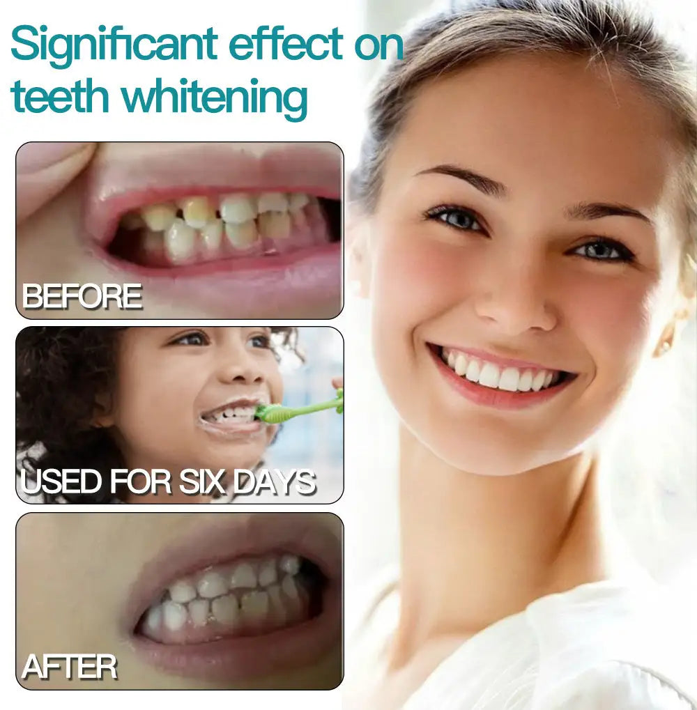 ✅Offiziellen Buttek | Glowrizon® Nano-Hydroxyapatit Zännpulver 🧑🏽⚕️