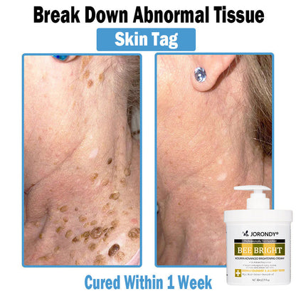 𝗝𝗼𝗿𝗼𝗻𝗱𝘆® Bee Bright Multi-Symptom Skin Treatment Cream