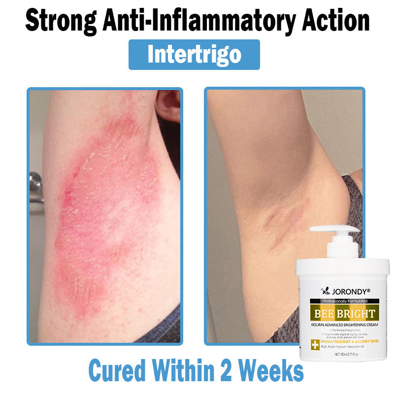 𝗝𝗼𝗿𝗼𝗻𝗱𝘆® Bee Bright Multi-Symptom Skin Treatment Cream