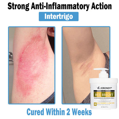 𝗝𝗼𝗿𝗼𝗻𝗱𝘆® Bee Bright Multi-Symptom Skin Treatment Cream