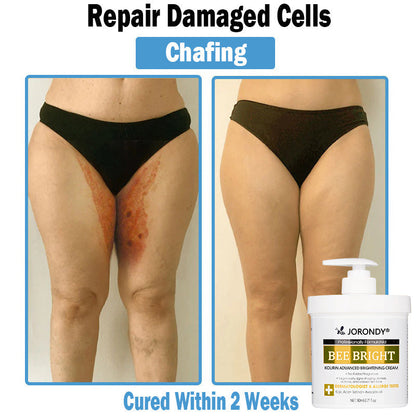 𝗝𝗼𝗿𝗼𝗻𝗱𝘆® Bee Bright Multi-Symptom Skin Treatment Cream