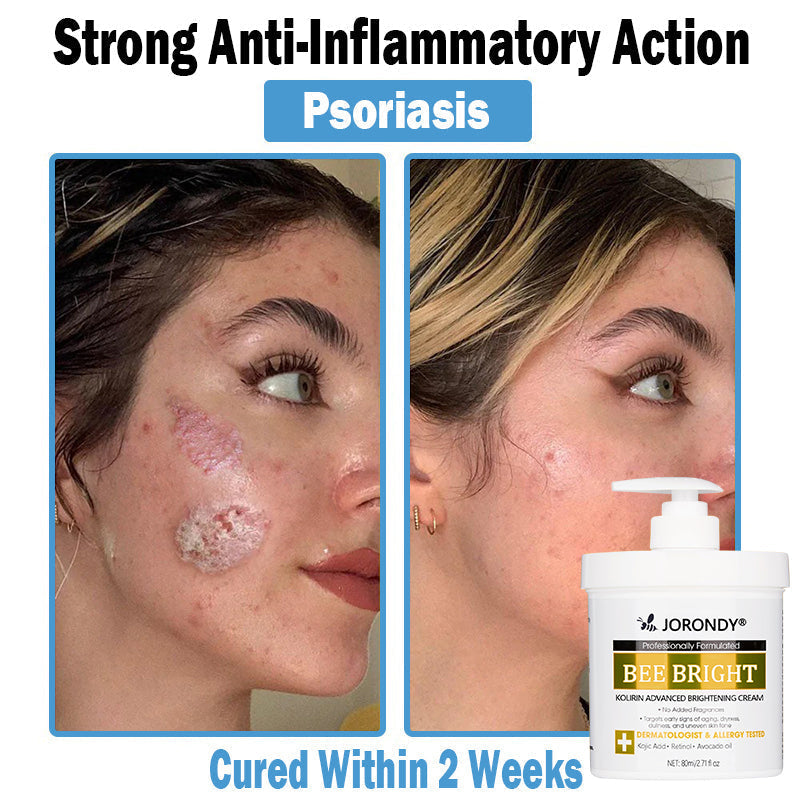 𝗝𝗼𝗿𝗼𝗻𝗱𝘆® Bee Bright Multi-Symptom Skin Treatment Cream