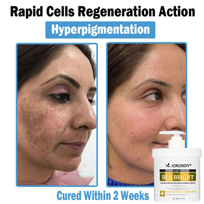 𝗝𝗼𝗿𝗼𝗻𝗱𝘆® Bee Bright Multi-Symptom Skin Treatment Cream