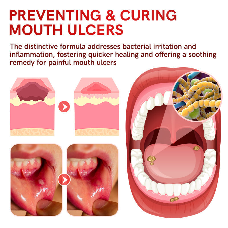 🔥2025HOT SALE🔥YAYASHI SP-6 Probiotic Whitening Toothpaste