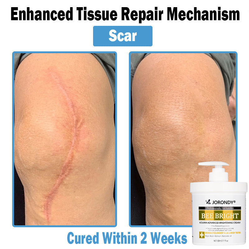 𝗝𝗼𝗿𝗼𝗻𝗱𝘆® Bee Bright Multi-Symptom Skin Treatment Cream