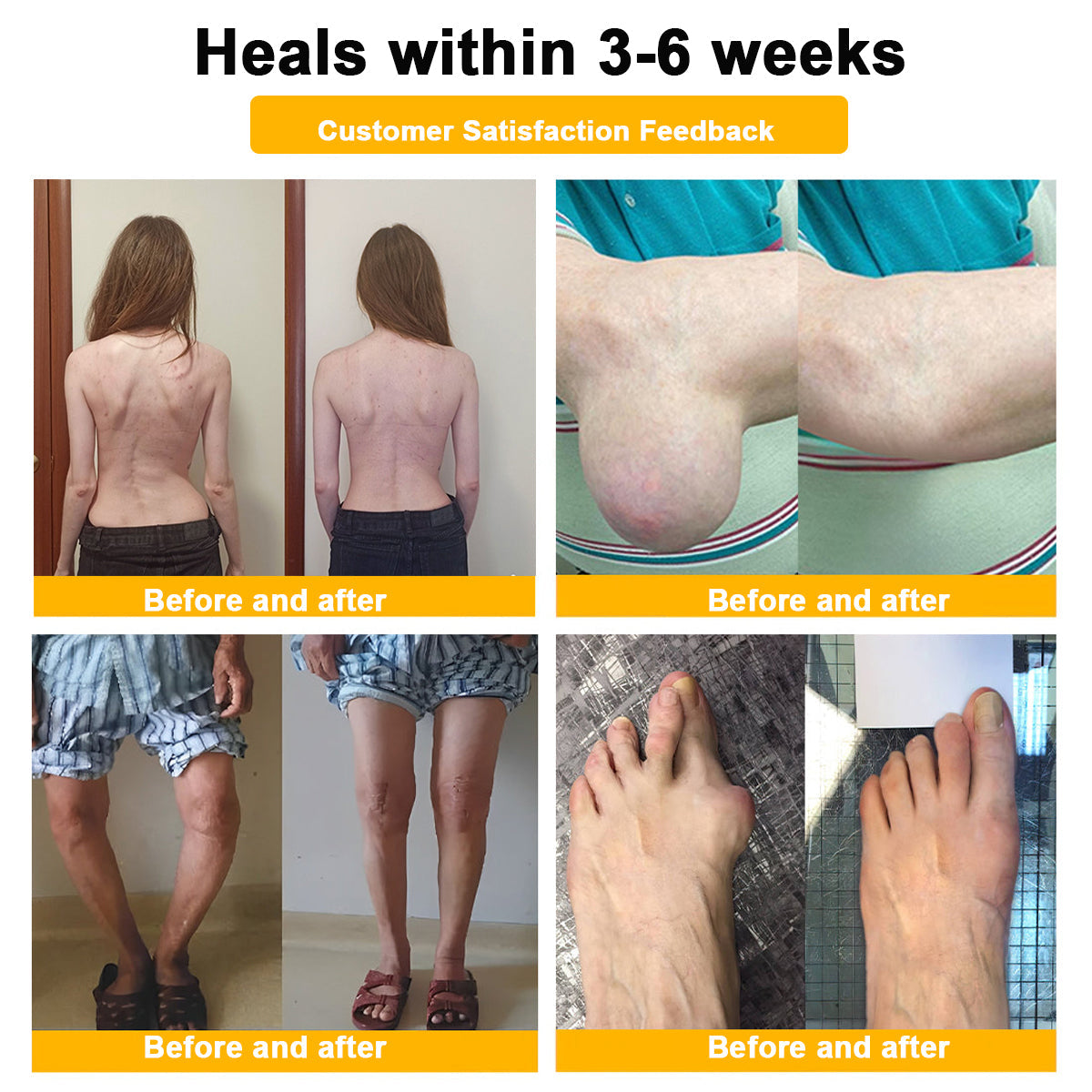 🐝AQA™ Botulinum & Bee Essence Pain-Relief Bone Healing Cream