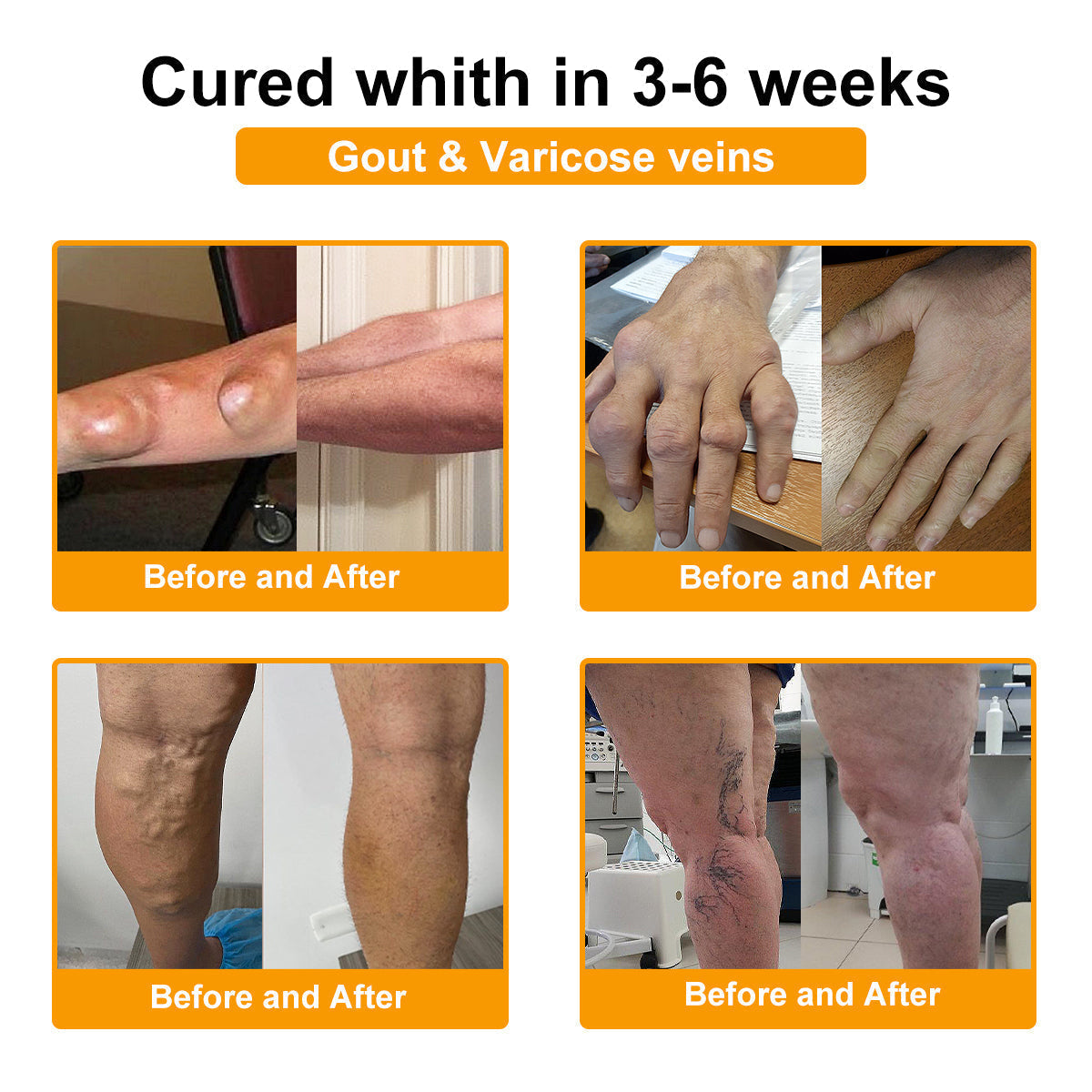 🐝AQA™ Botulinum & Bee Essence Pain-Relief Bone Healing Cream