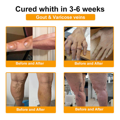 🐝AQA™ Botulinum & Bee Essence Pain-Relief Bone Healing Cream