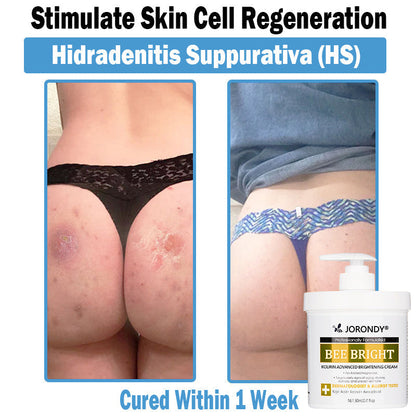 𝗝𝗼𝗿𝗼𝗻𝗱𝘆® Bee Bright Multi-Symptom Skin Treatment Cream