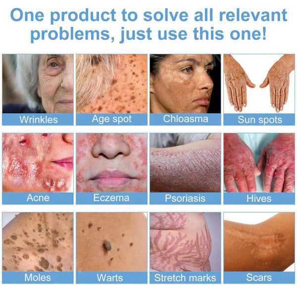 𝗝𝗼𝗿𝗼𝗻𝗱𝘆® Bee Bright Multi-Symptom Skin Treatment Cream