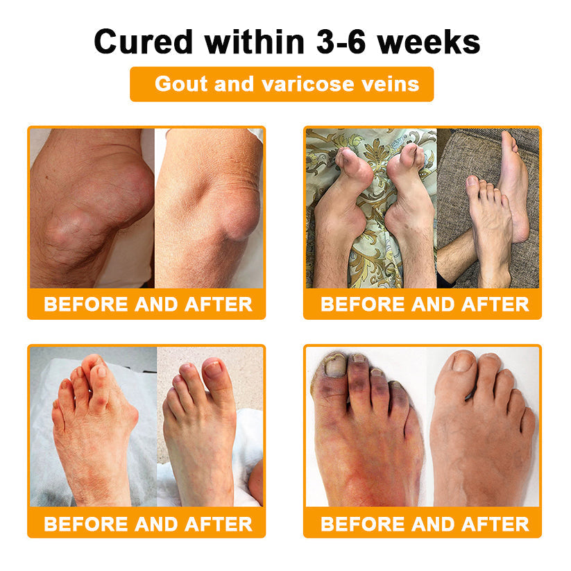 🐝AQA™ Botulinum & Bee Essence Pain-Relief Bone Healing Cream