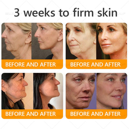 Made and Shipping from USA Bellelala Bee Venom Treatment Cream