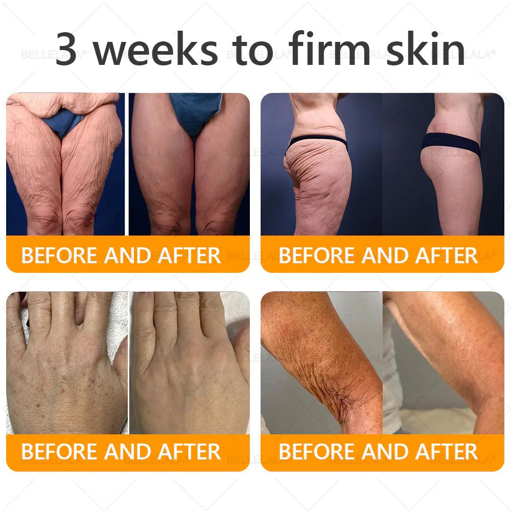 Made and Shipping from USA Bellelala Bee Venom Treatment Cream