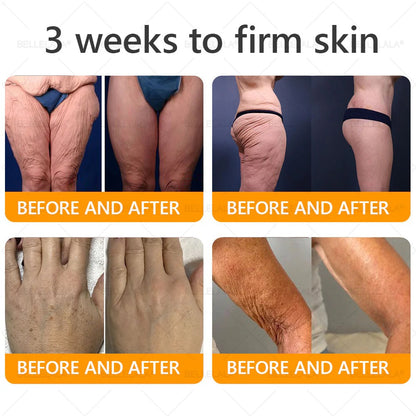 Made and Shipping from USA Bellelala Bee Venom Treatment Cream