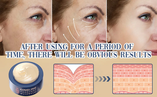 Qingling Wrinkle Removal Cream Japanese Qingling Polypeptide Anti-Wrinkle Cream Qingling Face Cream Qingling Wrinkle Remover Cream for Face Wrinkle Cream for Women(1PC)