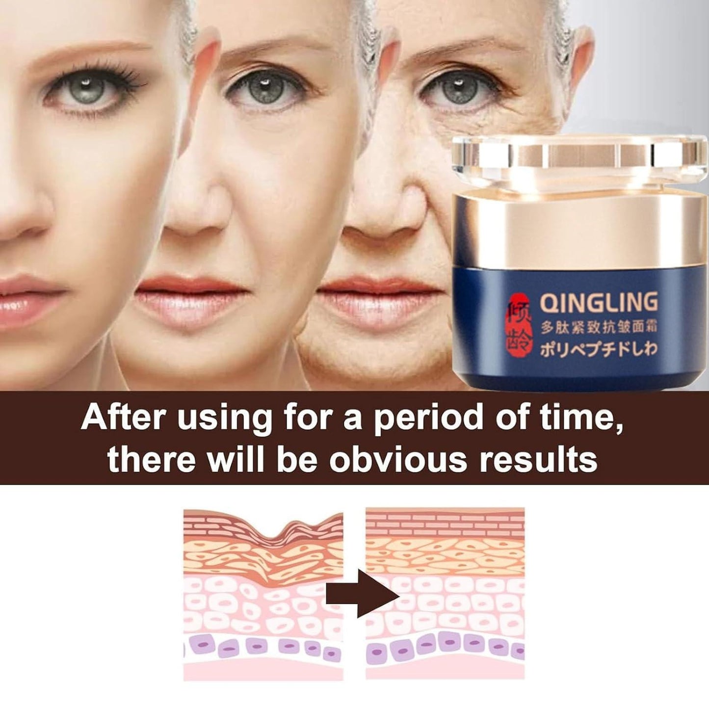 Qingling Wrinkle Removal Cream Japanese Qingling Polypeptide Anti-Wrinkle Cream Qingling Face Cream Qingling Wrinkle Remover Cream for Face Wrinkle Cream for Women(1PC)