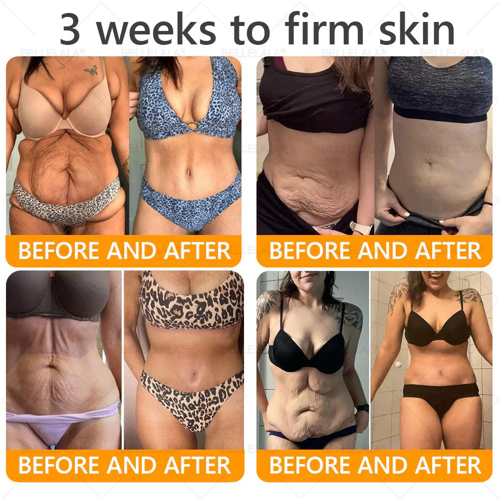 Made and Shipping from USA Bellelala Bee Venom Treatment Cream