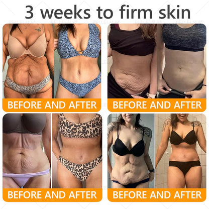 Made and Shipping from USA Bellelala Bee Venom Treatment Cream